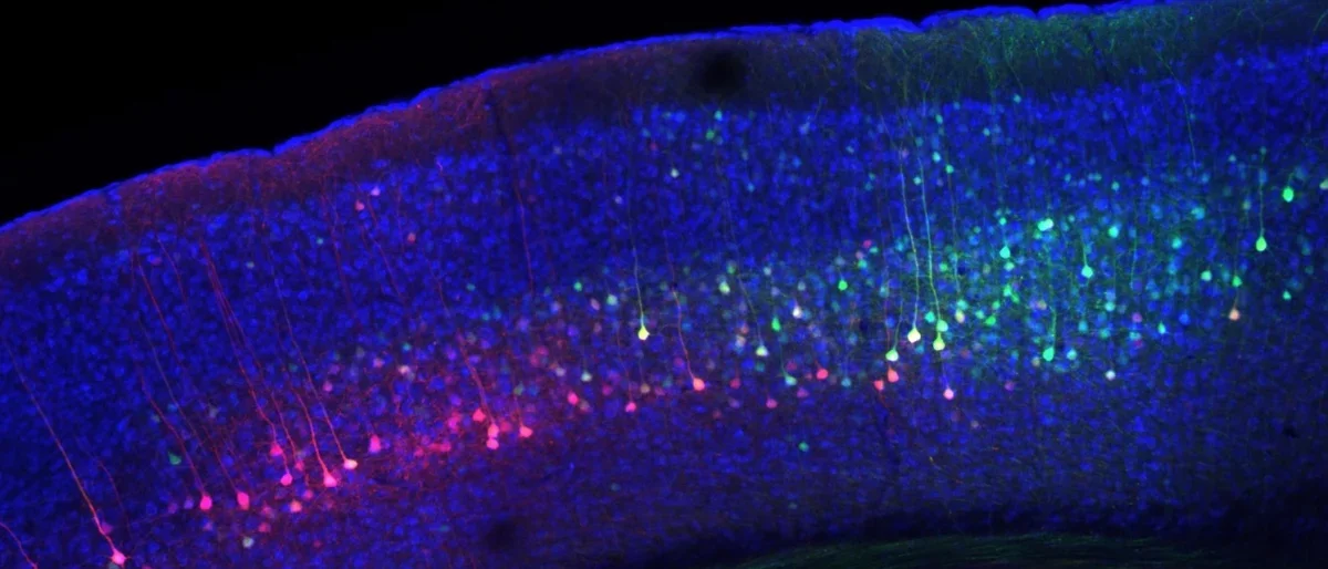 Corticostriatal projection neurons. Photo credit: Dr. Michael Ryan.
