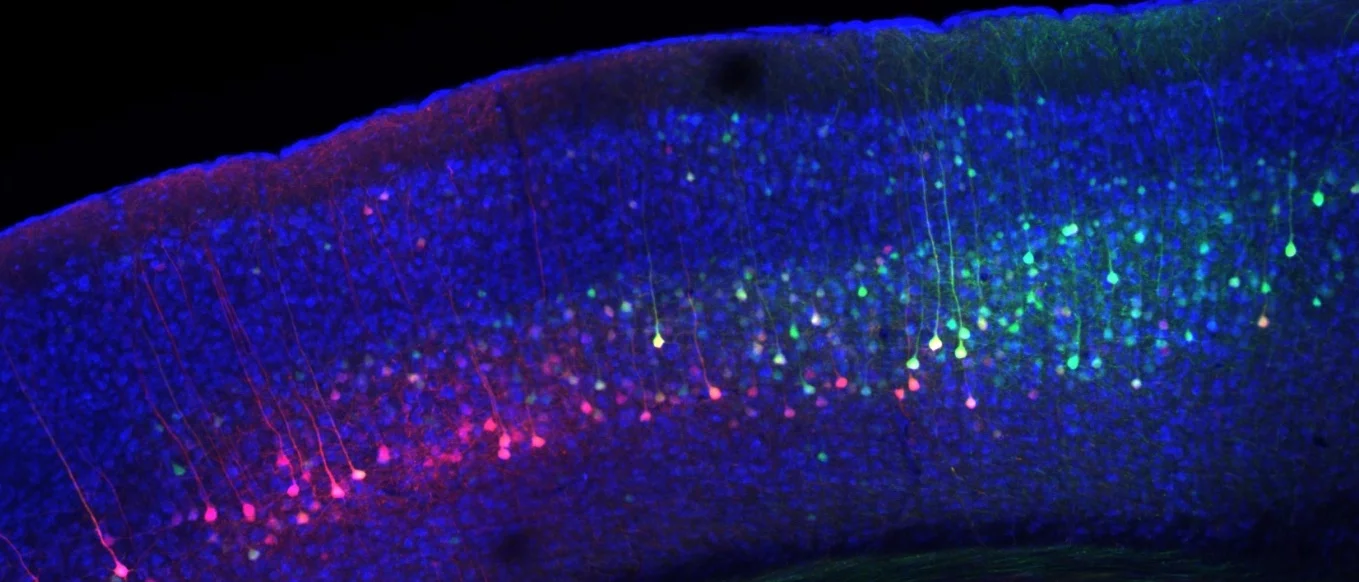 Corticostriatal projection neurons. Photo credit: Dr. Michael Ryan. 